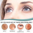 Whitening Freckle Cream Nicotinamide Dark Spot Remover Skin Care Moisturizing Brighten Anti-Aging Fade Spot Face Beauty