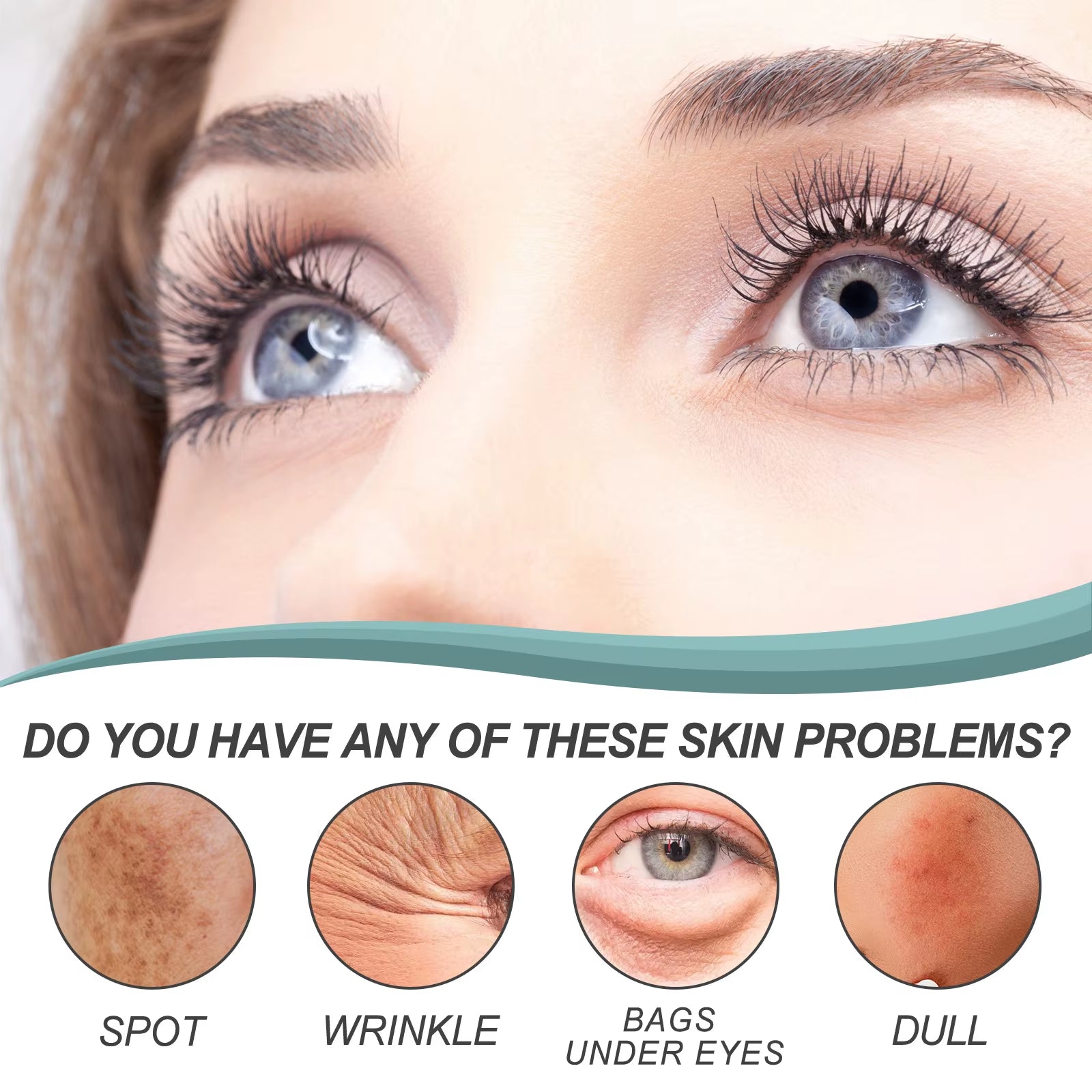 Whitening Freckle Cream Nicotinamide Dark Spot Remover Skin Care Moisturizing Brighten Anti-Aging Fade Spot Face Beauty