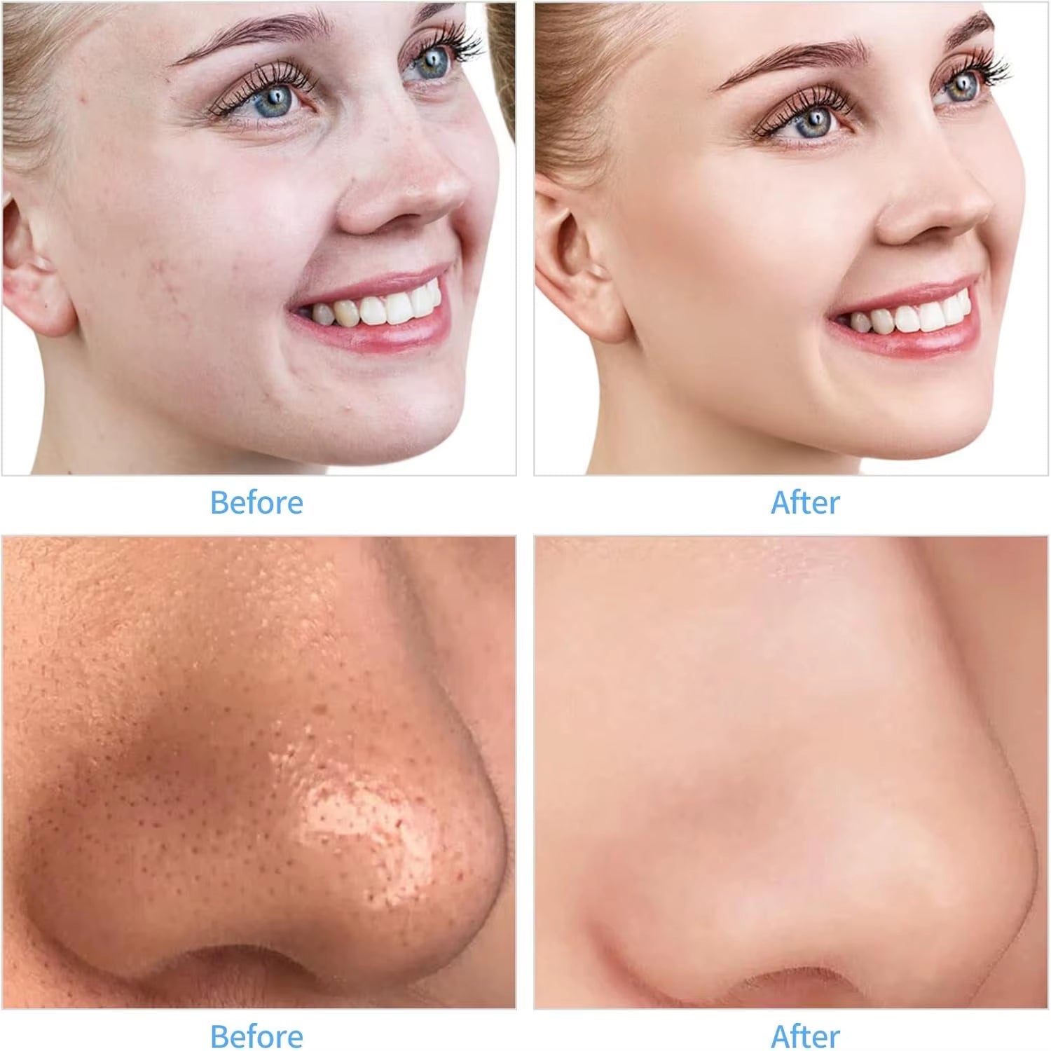 Handheld Diamond Microdermabrasion Machine Pore Vacuum Blackhead Removal for Skin Toning anti Aging Home Facial Treatment Device