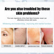Whitening Freckle Cream Nicotinamide Dark Spot Remover Skin Care Moisturizing Brighten Anti-Aging Fade Spot Face Beauty