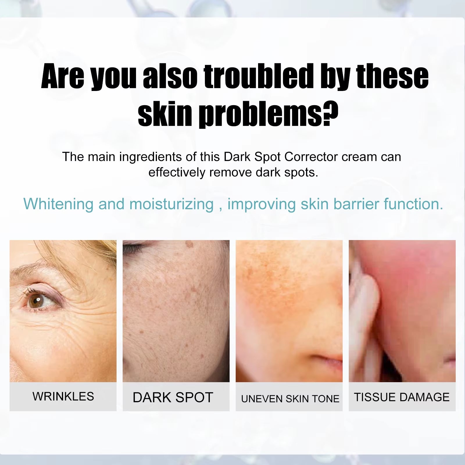 Whitening Freckle Cream Nicotinamide Dark Spot Remover Skin Care Moisturizing Brighten Anti-Aging Fade Spot Face Beauty